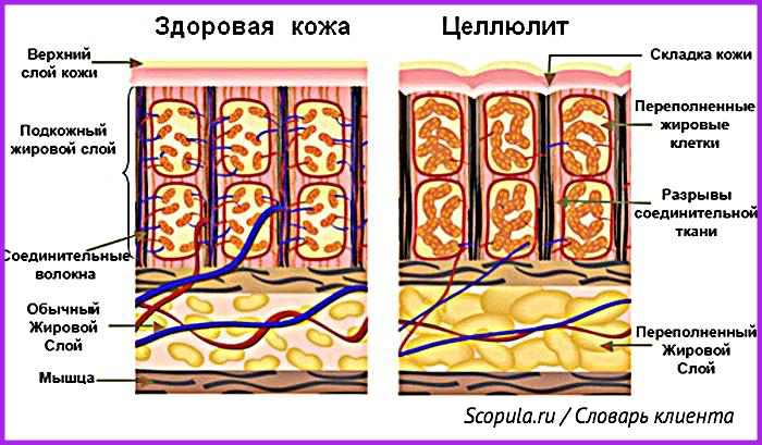 вакуумно роликовый массаж тела что это такое. Смотреть фото вакуумно роликовый массаж тела что это такое. Смотреть картинку вакуумно роликовый массаж тела что это такое. Картинка про вакуумно роликовый массаж тела что это такое. Фото вакуумно роликовый массаж тела что это такое